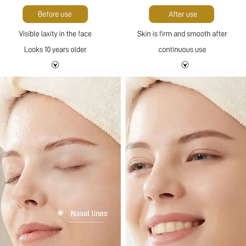 Fading Lines Patch Moisturizing AntiWrinkle Decree Gel for Dry Lines Lifting and Firming