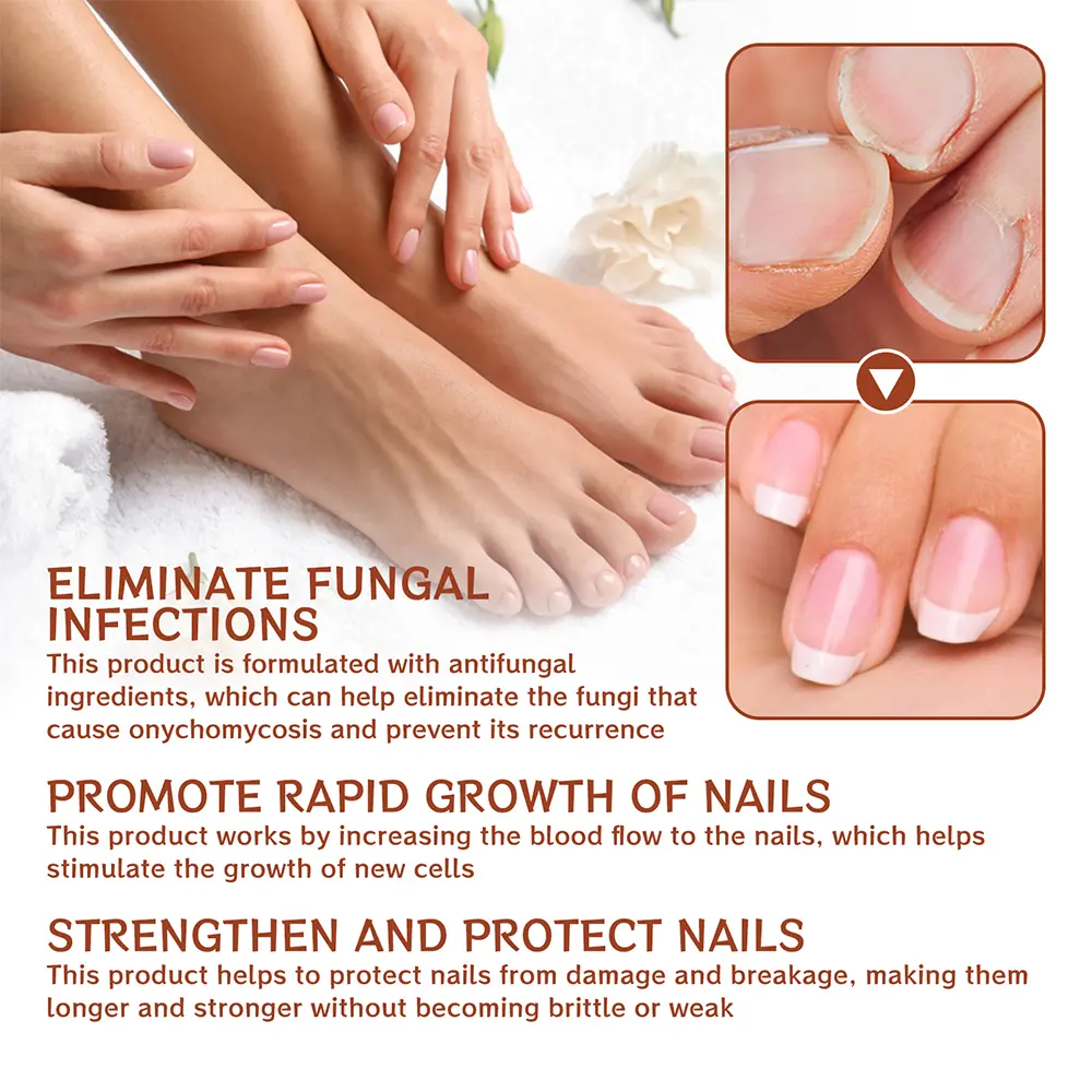 20ML Nail Growth And Strengthening Serum Nourishing Strength Care Essence Repairing Damaged Growth Nail Treatment Liquid