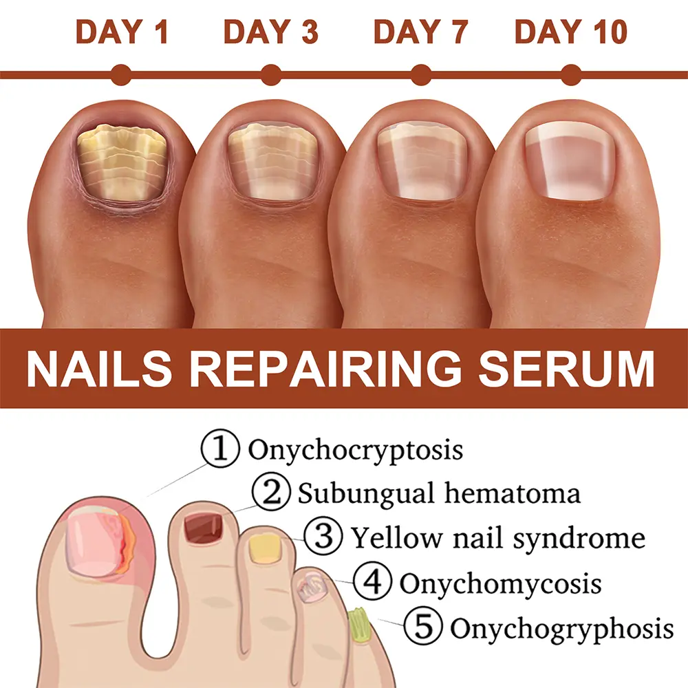 20ML Nail Growth And Strengthening Serum Nourishing Strength Care Essence Repairing Damaged Growth Nail Treatment Liquid