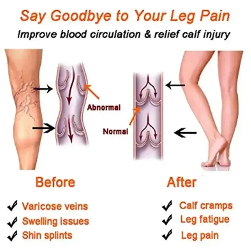 Women Compression Socks Sock Men Outdoor Sports Prevent Calf Varicose Veins Soreness Pressure Calf Stocking Sock
