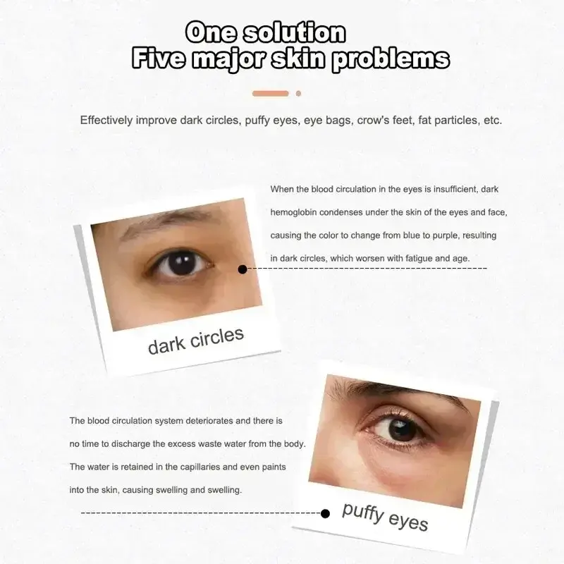 4 in 1 Electric Facial Massager Micro Vibration Eye Beauty Instrument for Relax Eye Dark Circles Eye Bags Wrinkles Puffiness