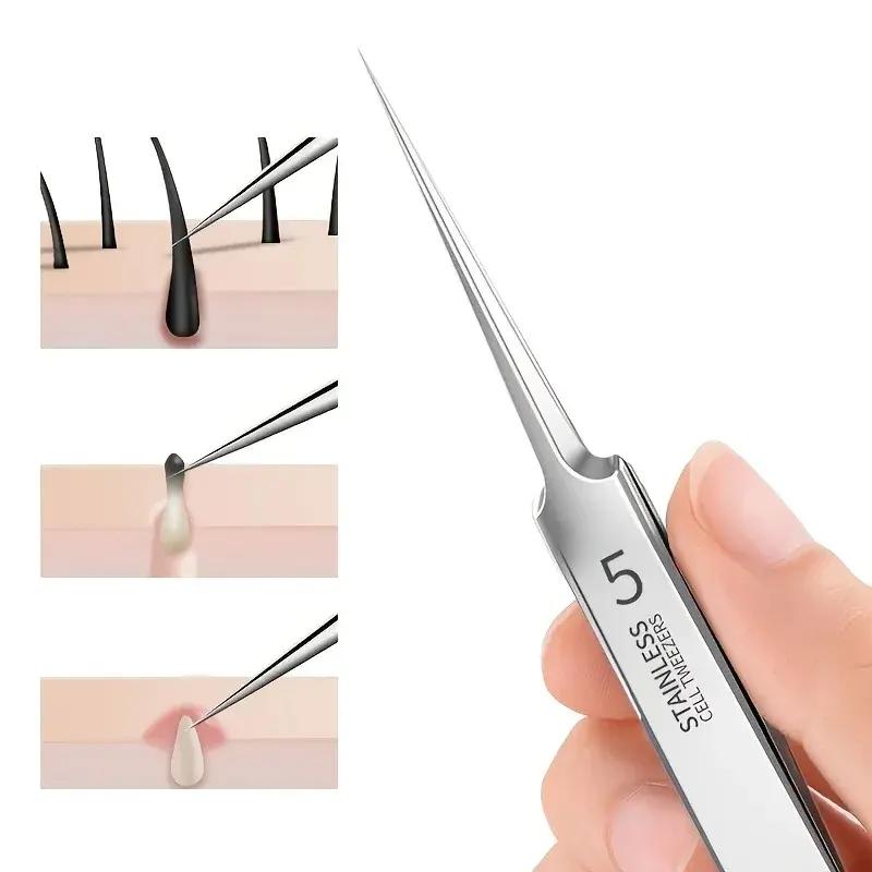New 1 Pack Extra Fine No. 5 Cellular Acne Blackhead Tweezers - Facial Beauty Remove Acne Needle Tools for Skin Care
