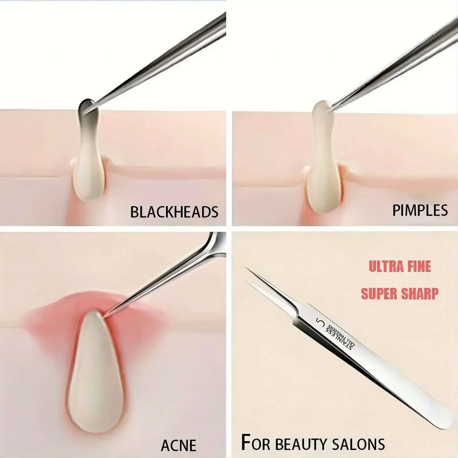 New 1 Pack Extra Fine No. 5 Cellular Acne Blackhead Tweezers - Facial Beauty Remove Acne Needle Tools for Skin Care
