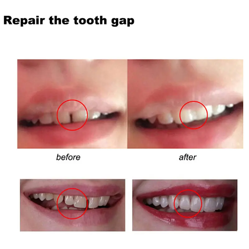 10/50/100g Dental Resin Shapeable Teeth Glue Temporary Filling Teeth Repair Makeup Dental Material Particles