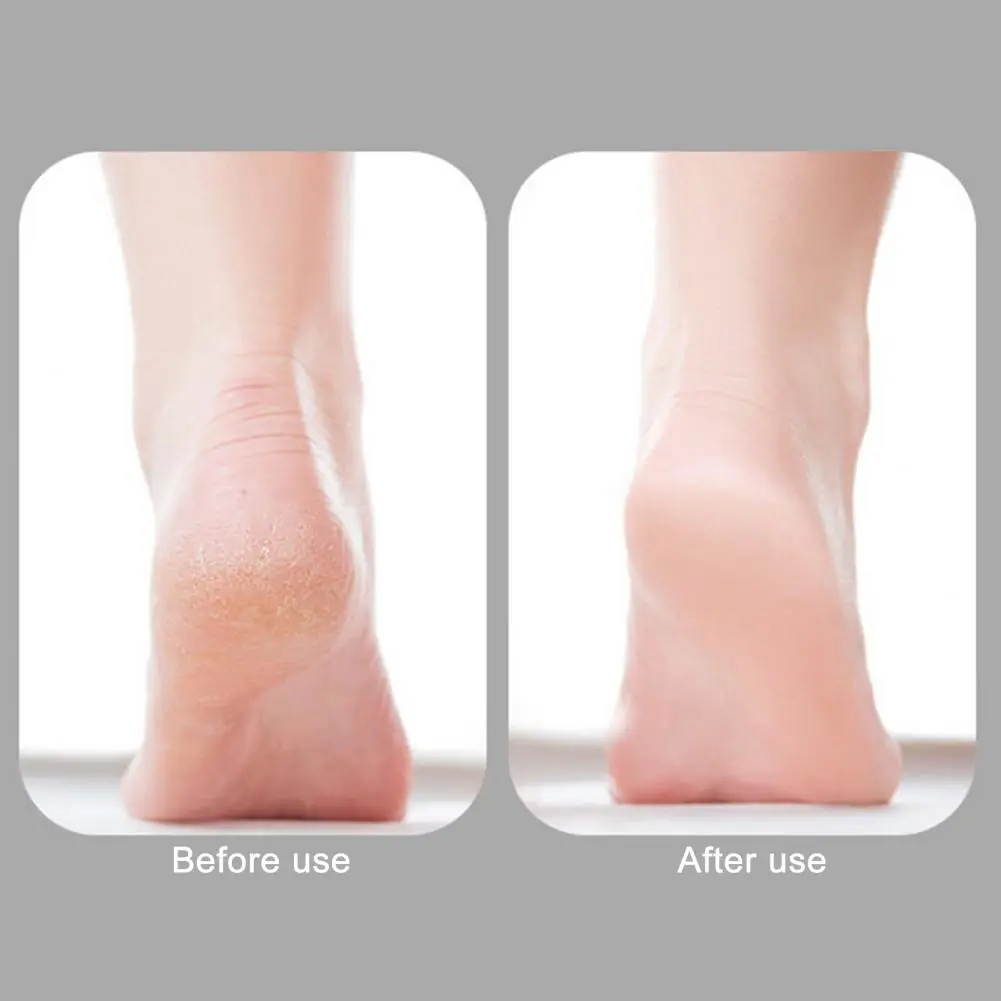 Foot File with Edges Nanometer Glass Foot File Callus Remover Set Professional Dead Skin Removal Kit for Exfoliating for Smooth