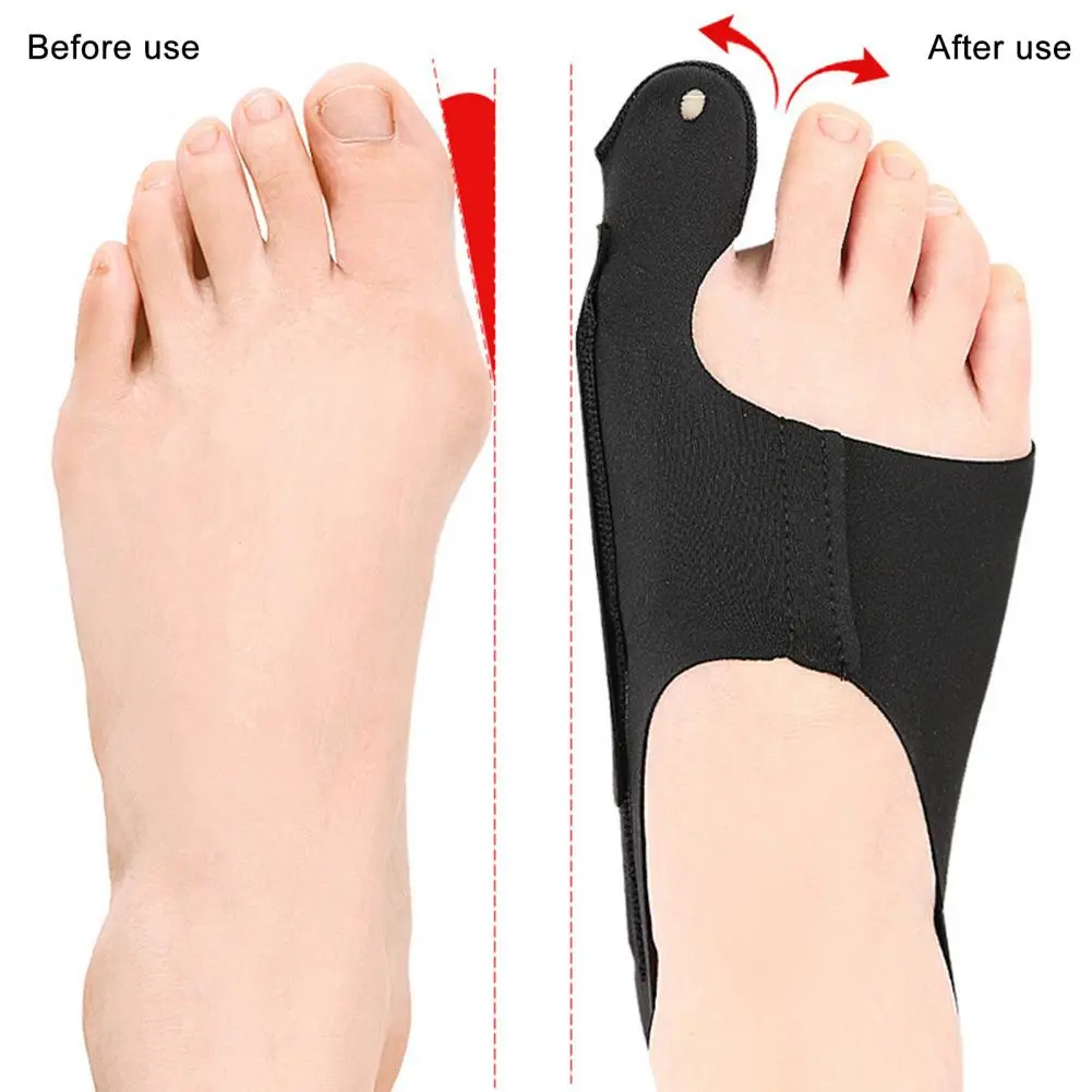 Sebs Side Foot Sleeve Adjustable Bunion Corrector for Pain Relief Toe Straightening Wear Resistant Design for Bunions Correction