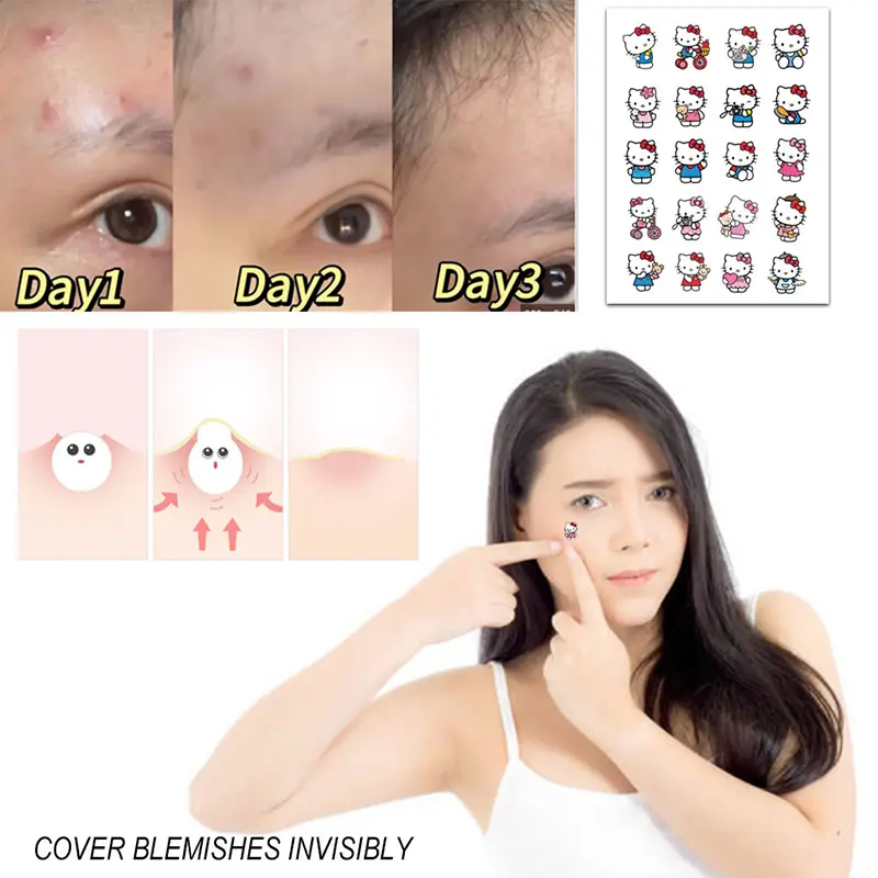 100pcs Sanrio HelloKitty Shaped Acne Sticker Cartoon Kuromi Acne Patches Invisible Acne Cover Removal Pimple Patch Skin Care