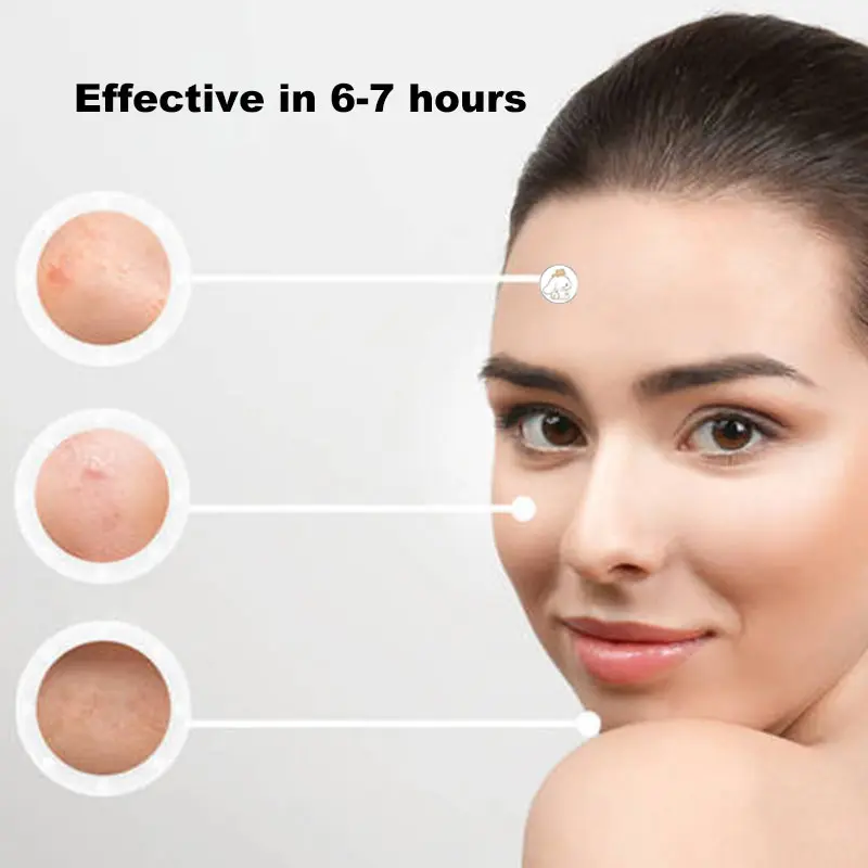 96/100/120pcs Sanrio Cinnamoroll Repair Acne Patch Facial Skin Care Fade Blemishes Pimple Marks Closed Acne