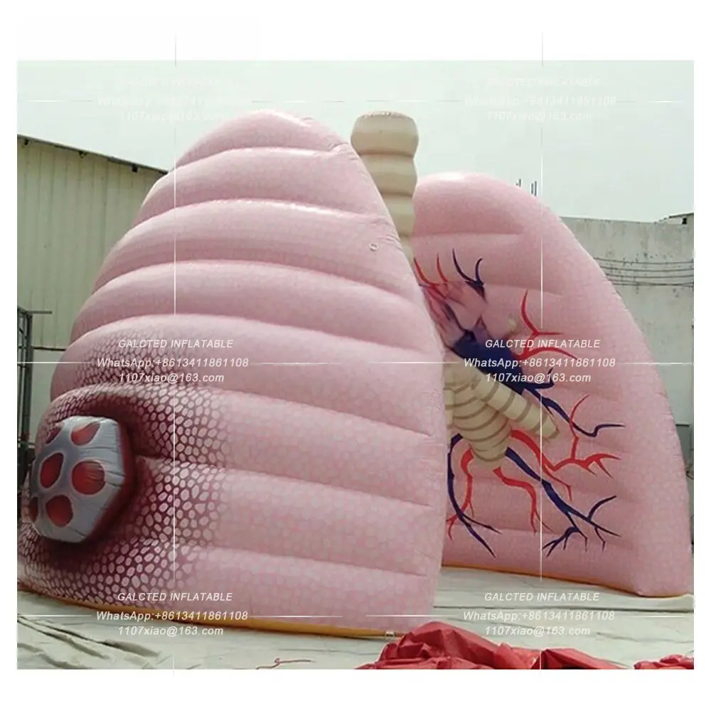 Giant Inflatable Lung Model Demonstrating School Teaching Human Organs Ballooning for Medical Activity