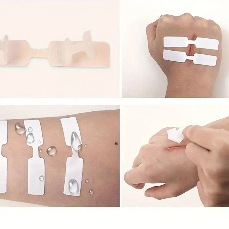 Outdoor Wound Adhesive Tape Disposable First Aid Wound Suture Patch Wound Band Aid Emergency Quick Suture Patch