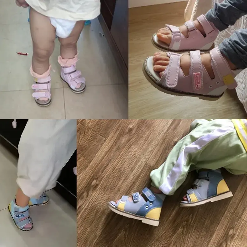 Summer Black Sandal Kid Orthopedic Leather Open Toe  Children School Boys Girls Shoes Tiptoe Flatfoot Footwear With arch support