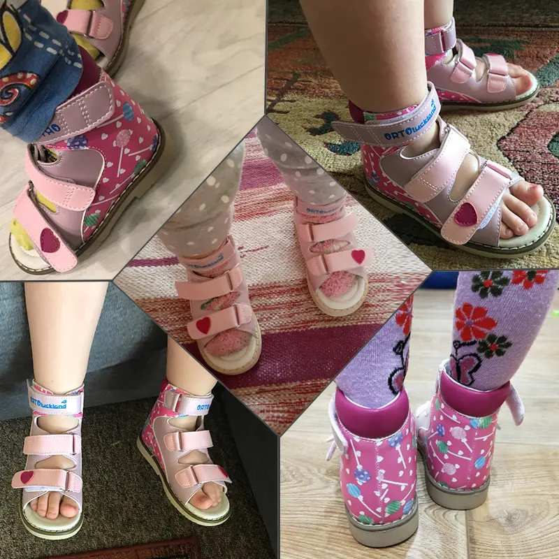 Ortoluckland Toddler Girls Summer Sandals Baby Orthopedic Shoes For Children Kids 2024 Korean Style Dance Pink Open Toe Footwear