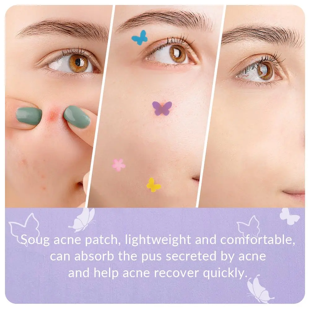 120 Counts Cute Colorful Butterfly Pimple Patches Acne Treatment Stickers Invisible Acne Cover Face Spot Pimple Patch Skin Care