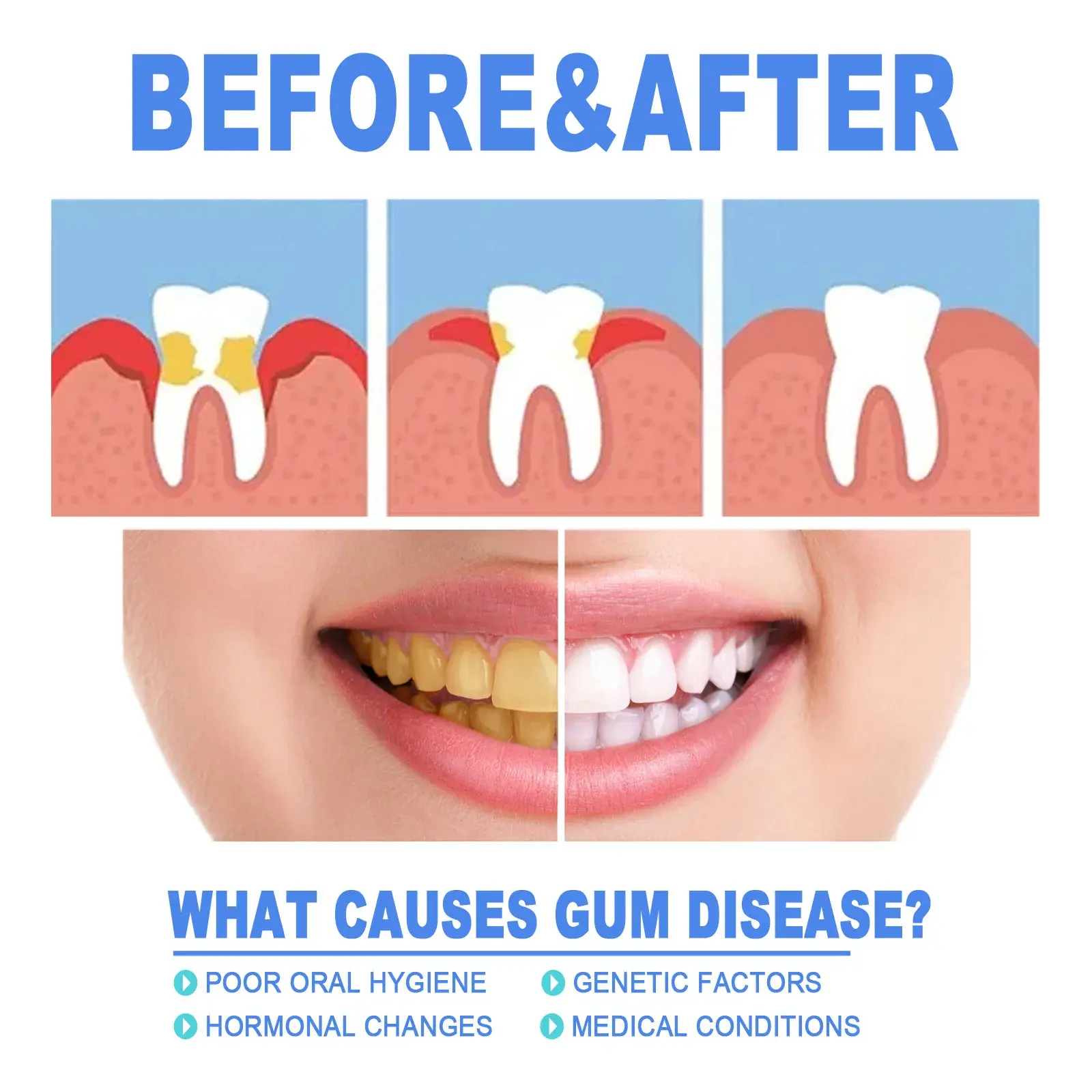 Gum Repair Gel Rebuilding Strengthen Whiten Remove Tooth Stains Anti Gingival Inflammation Recession Bad Breath Protect Oral Gel