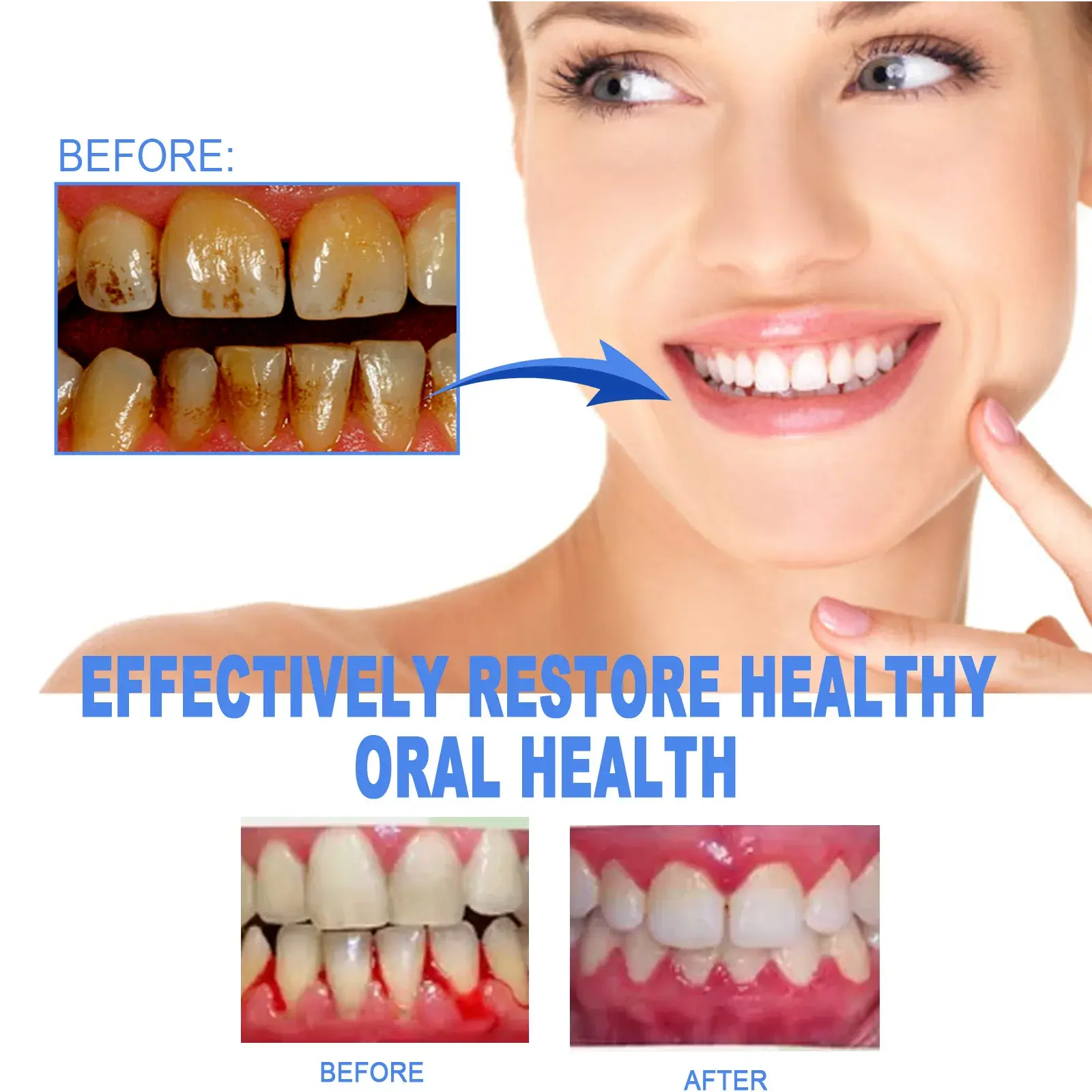Gum Repair Gel Rebuilding Strengthen Whiten Remove Tooth Stains Anti Gingival Inflammation Recession Bad Breath Protect Oral Gel