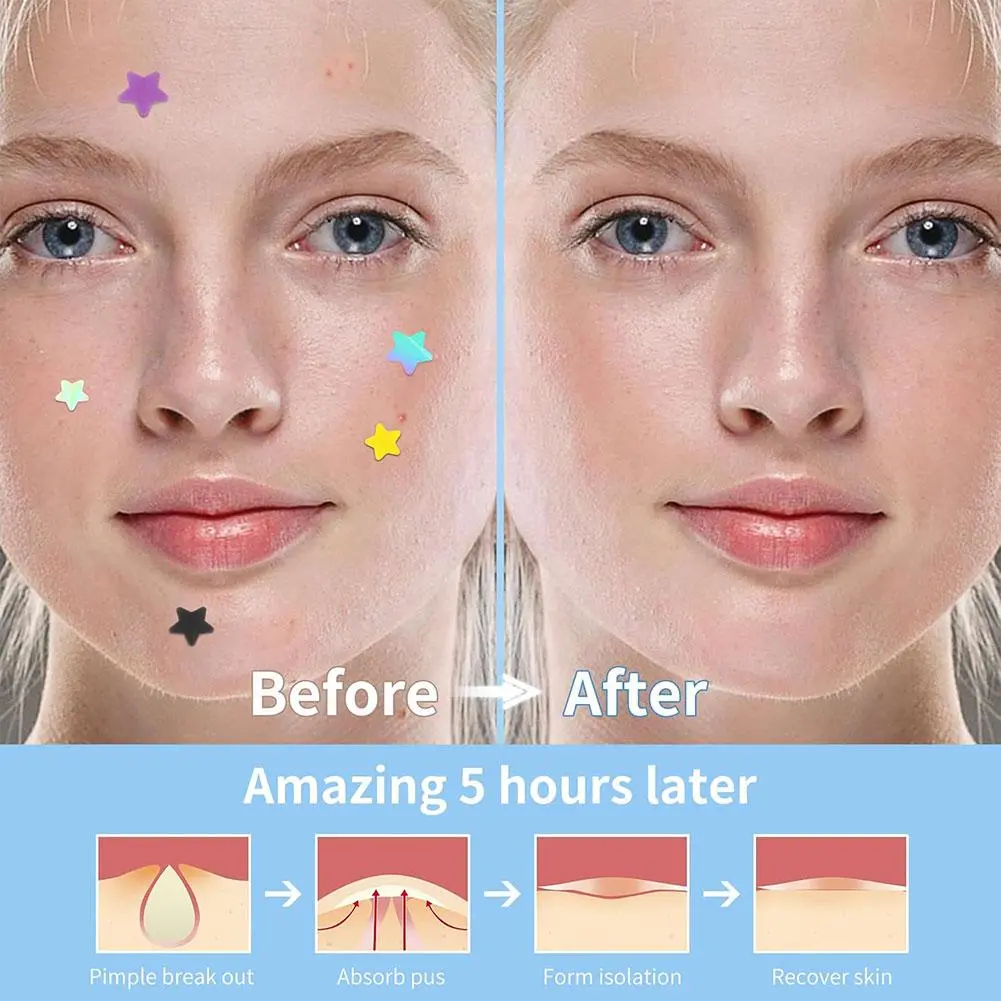 Colorful Hydrocolloid Dots Cute Star Heart Shaped Acne Pimple Patch For Face Invisible Zits & Blemishes Cover Stickers Skin Care