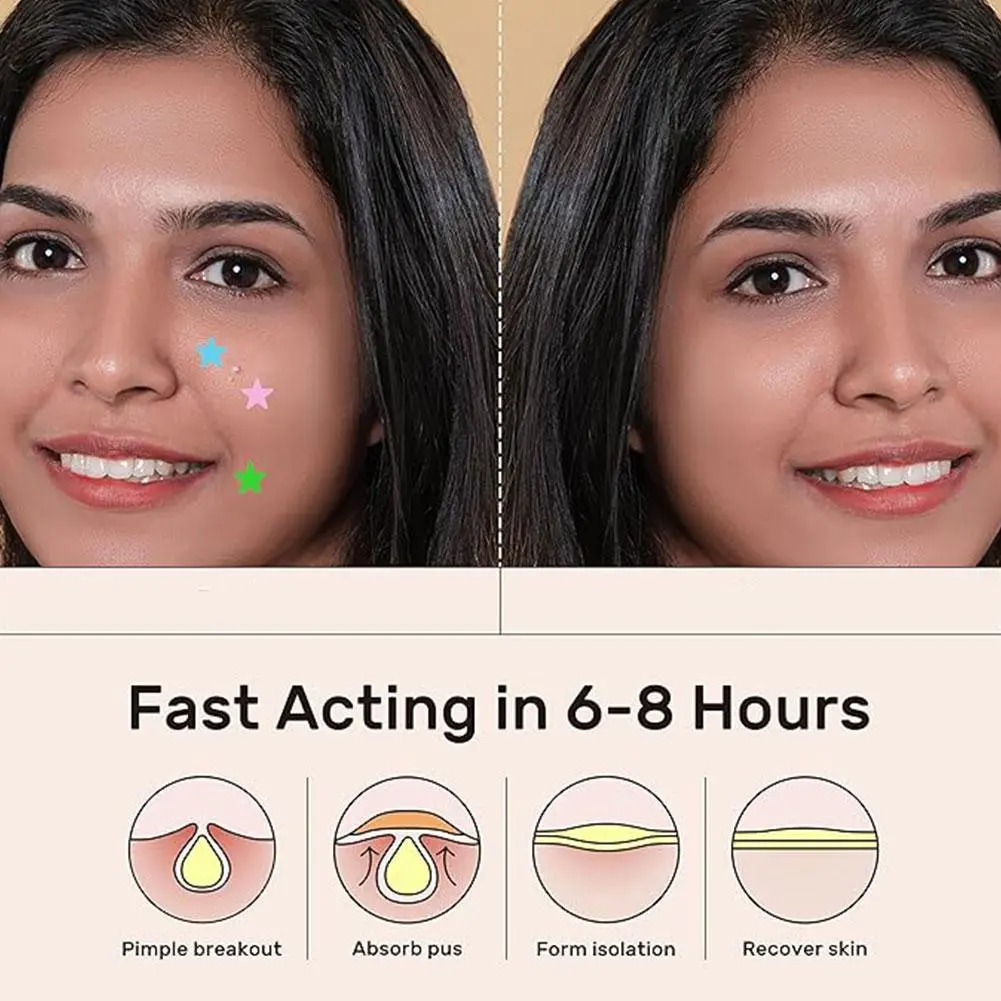 Colorful Hydrocolloid Dots Cute Star Heart Shaped Acne Pimple Patch For Face Invisible Zits & Blemishes Cover Stickers Skin Care