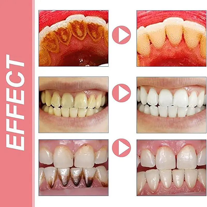 SP-10 Probiotic Toothpaste Whiten Tooth Remove Plaque Stains Teeth Whitener Oral Hygiene Clean Fresh Breath Teeth Care Products