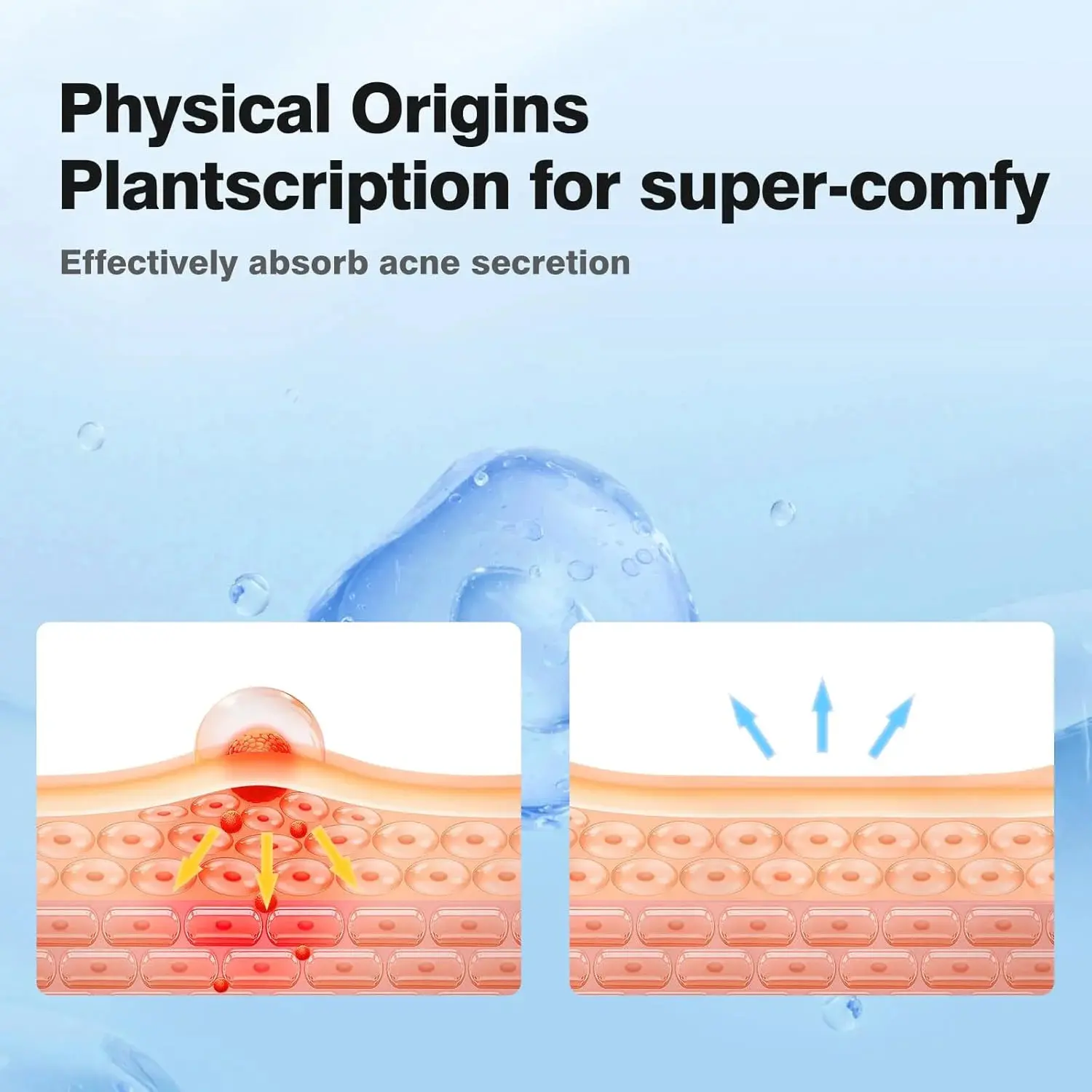 1/2/3 Box Acne Pimple Patches Star Hydrocolloid Spot Cover Face Invisible Stickers Patch Acne for Covering Zits and Blemishes
