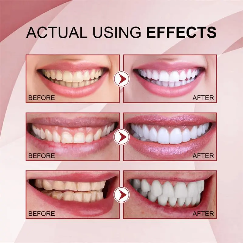 SP-10 Probiotic Toothpaste Whiten Tooth Remove Plaque Stains Teeth Whitener Oral Hygiene Clean Fresh Breath Teeth Care Products