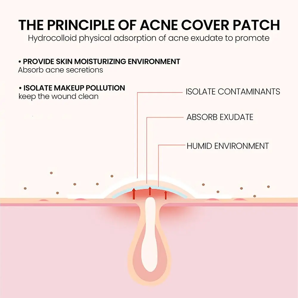 200pcs Colorful Star-Shaped Hydrocolloid Invisible Pimple Patches For Face, Cute Zit Cover Stickers Skin Care