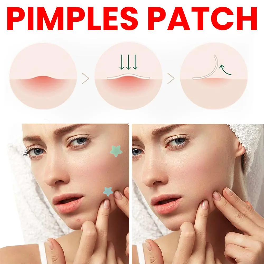 200pcs Colorful Star-Shaped Hydrocolloid Invisible Pimple Patches For Face, Cute Zit Cover Stickers Skin Care