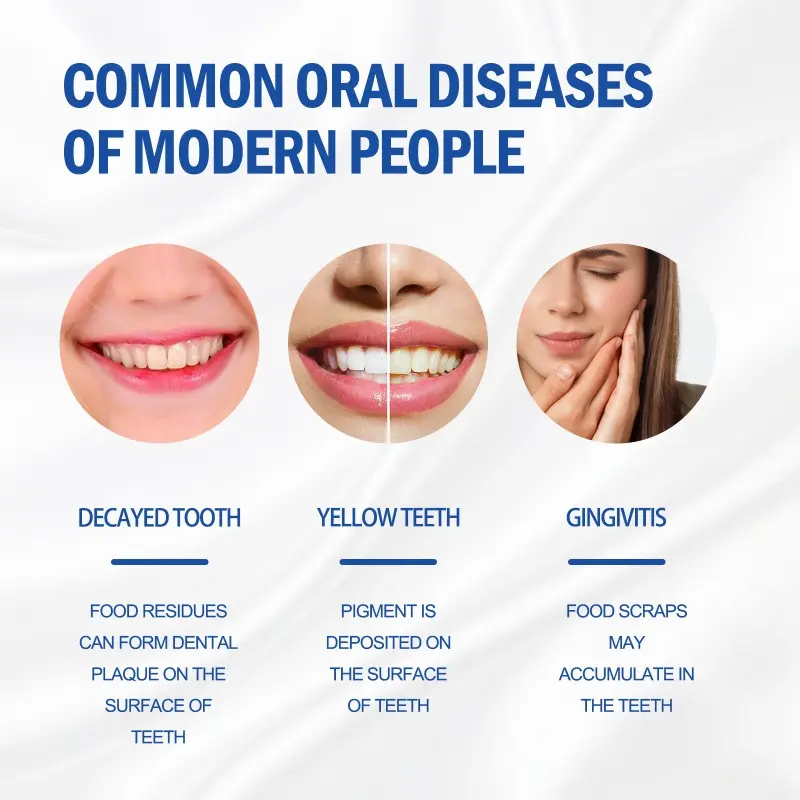 Sip-4 Probiotic Whitening Toothpaste Brightening & Stain Removing Sp-4 Probiotic Toothpaste Fresh Breath Teeth Whiten Toothpaste