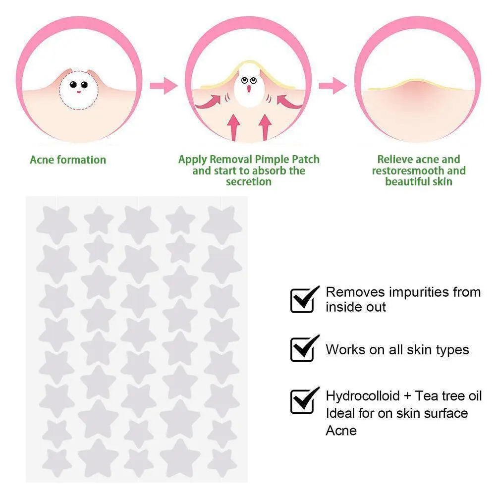 Colorful Star Shaped PE Pimple Patches Acne Cover Invisible Removal Skin Care Stickers Face Spot Concealer Beauty Makeup Tools