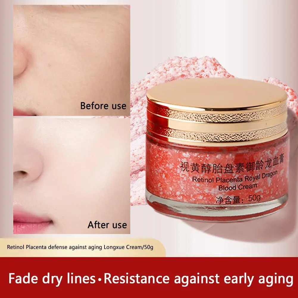Dragons Blood Easy Cream, Retinol Placenta Dragon Blood Face Cream, Anti Wrinkle Cream For Women Rejuvenate Skin Care 50g
