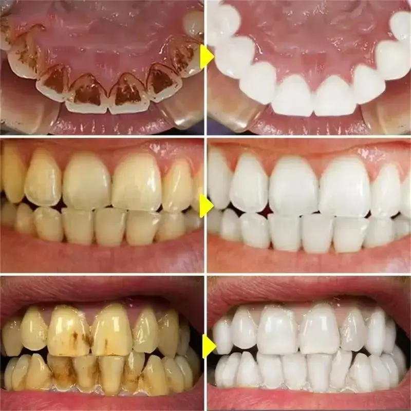 Magical Teeth Whitening Pen Effectively Removes Dental Plaque Coffee Stains Smoke Stains Freshens Breath Teeth Whitening Care