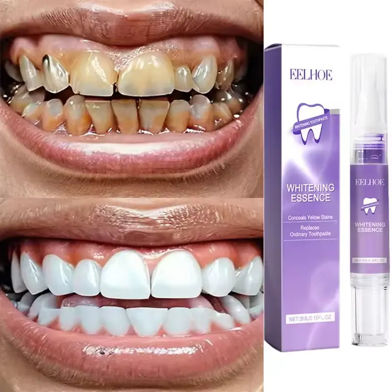 Magical Teeth Whitening Pen Effectively Removes Dental Plaque Coffee Stains Smoke Stains Freshens Breath Teeth Whitening Care