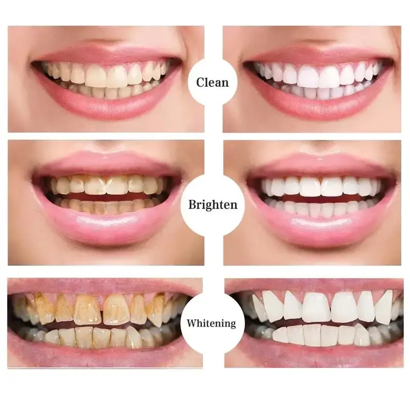 Magical Teeth Whitening Pen Effectively Removes Dental Plaque Coffee Stains Smoke Stains Freshens Breath Teeth Whitening Care