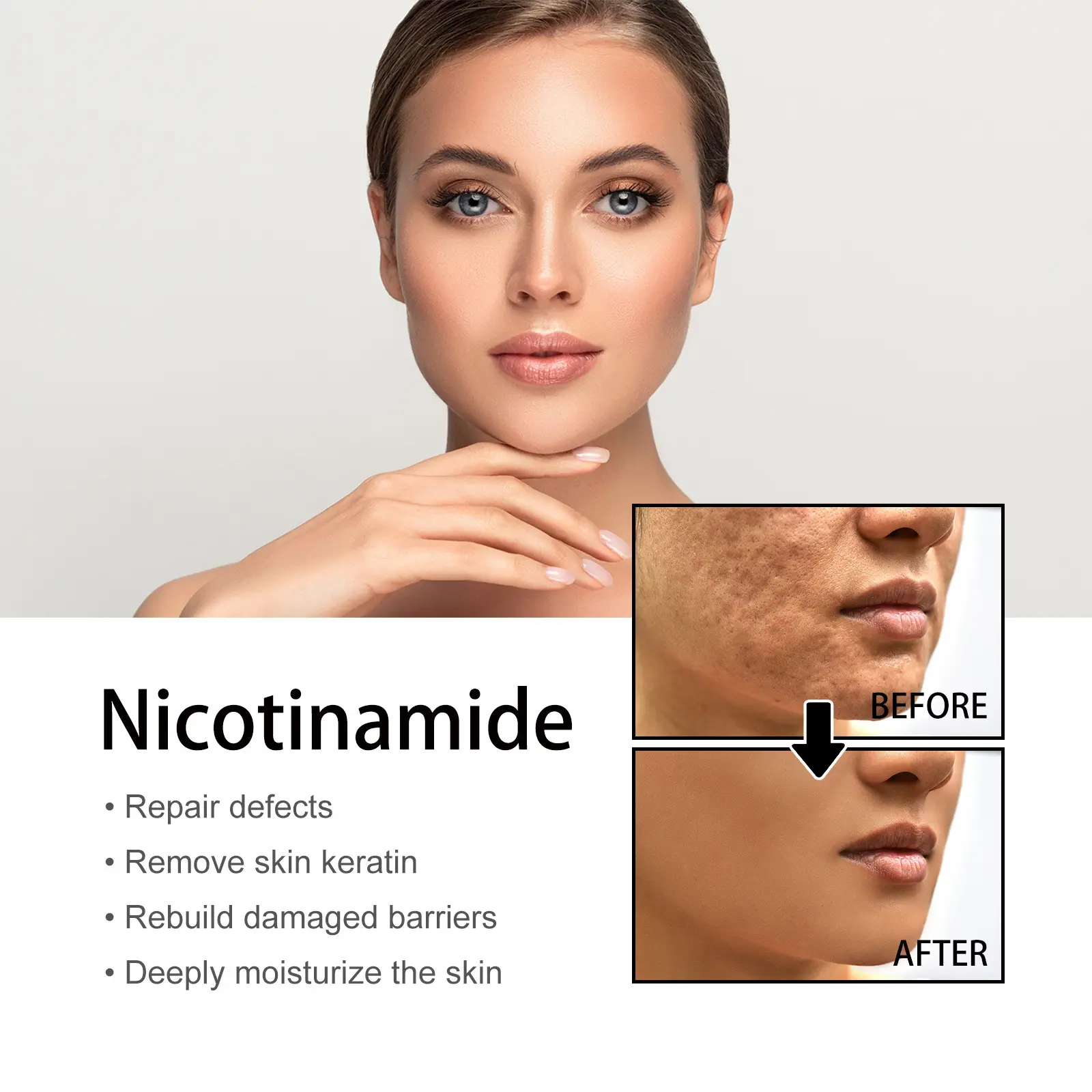 Nicotinamide Serum Effective Whitening Essence Remove Dark Spots Freckle Fade Pigmentation Melasma Correction Brighten Skin Care