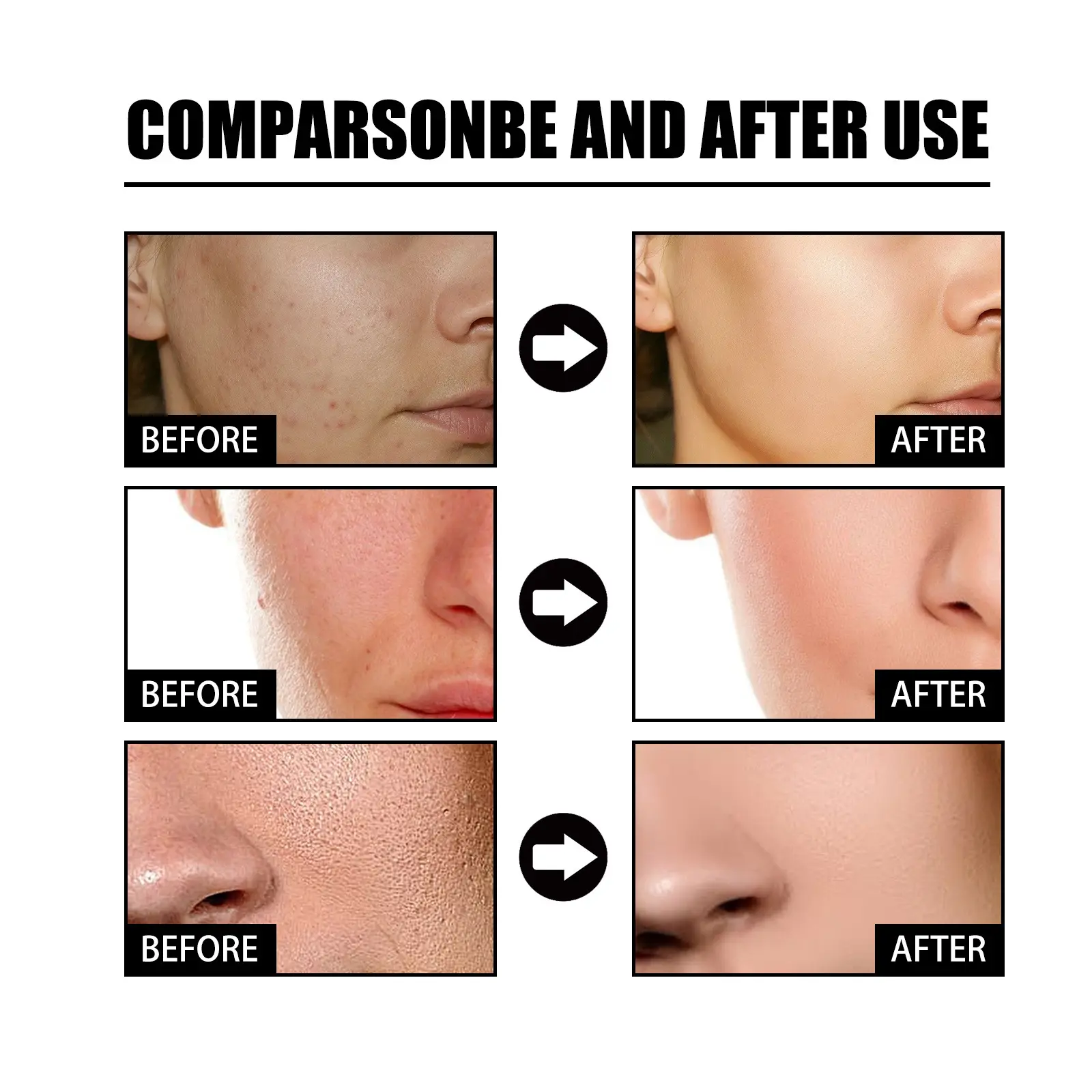 Nicotinamide Serum Effective Whitening Essence Remove Dark Spots Freckle Fade Pigmentation Melasma Correction Brighten Skin Care