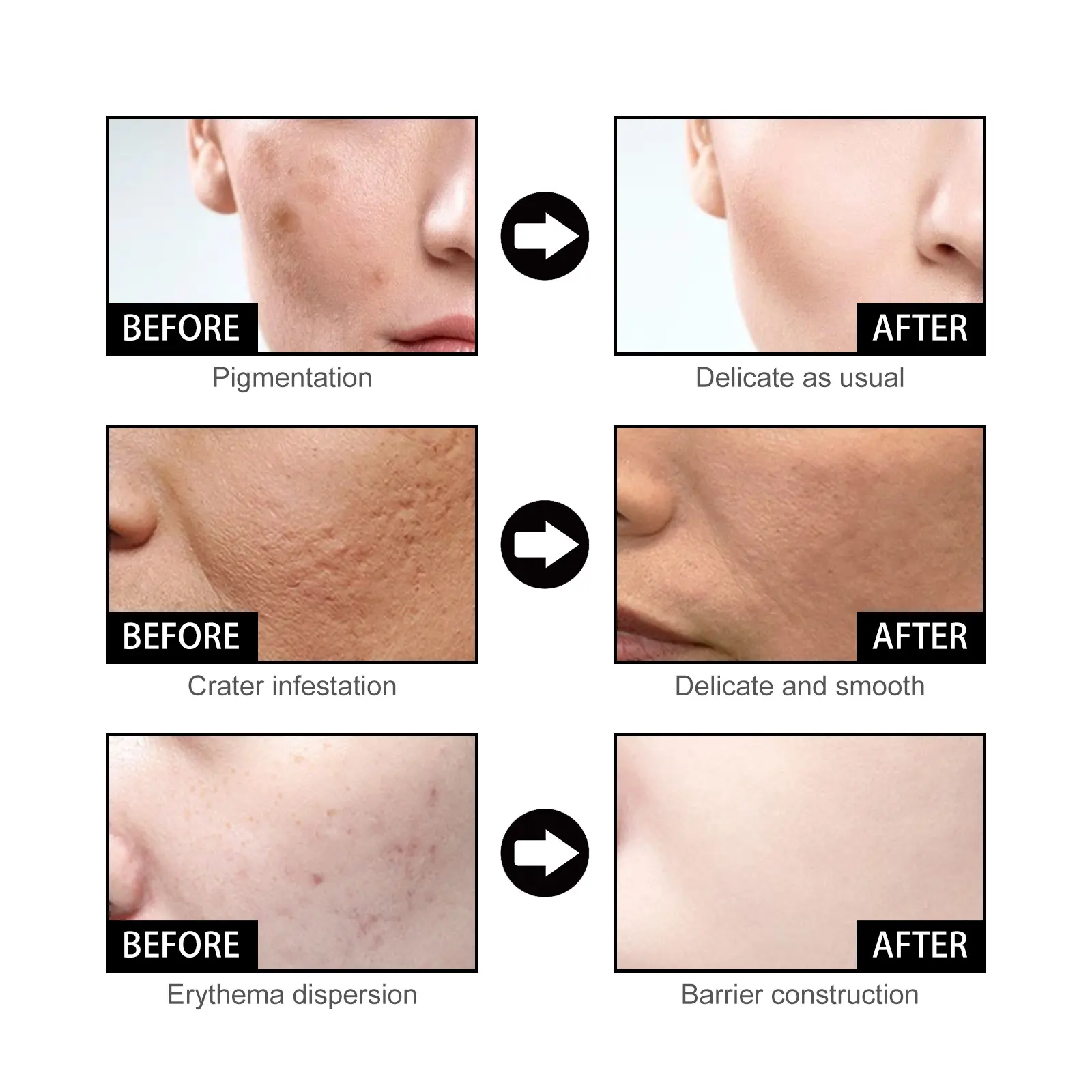 Nicotinamide Serum Effective Whitening Essence Remove Dark Spots Freckle Fade Pigmentation Melasma Correction Brighten Skin Care