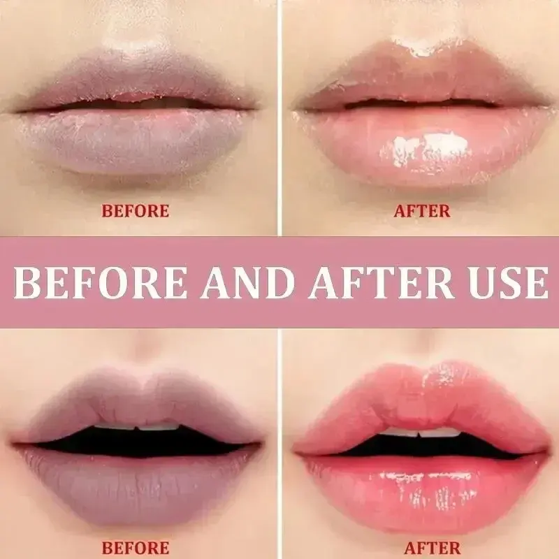 Remove Dark Lip Balm Lightening Melanin Mask Gloss Oil Exfoliating Clean Moisturizer Korean Care Makeup Beauty Products