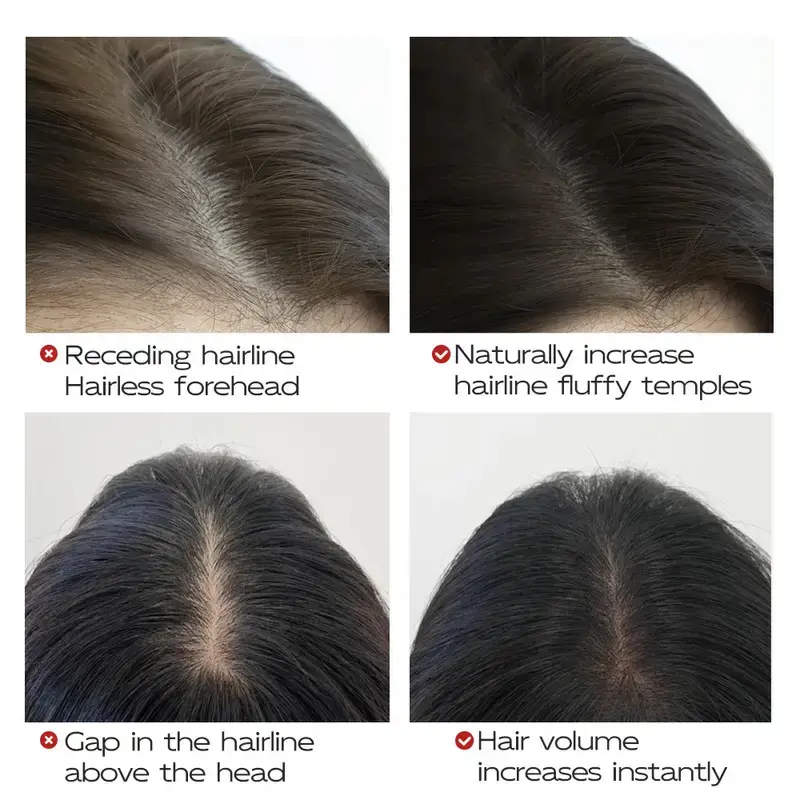 5 Colors Waterproof Hairline Concealer Stick-Instant Cover Gray Hair, Natural Looking, Sweat-Proof&Long Lasting for Men & Women