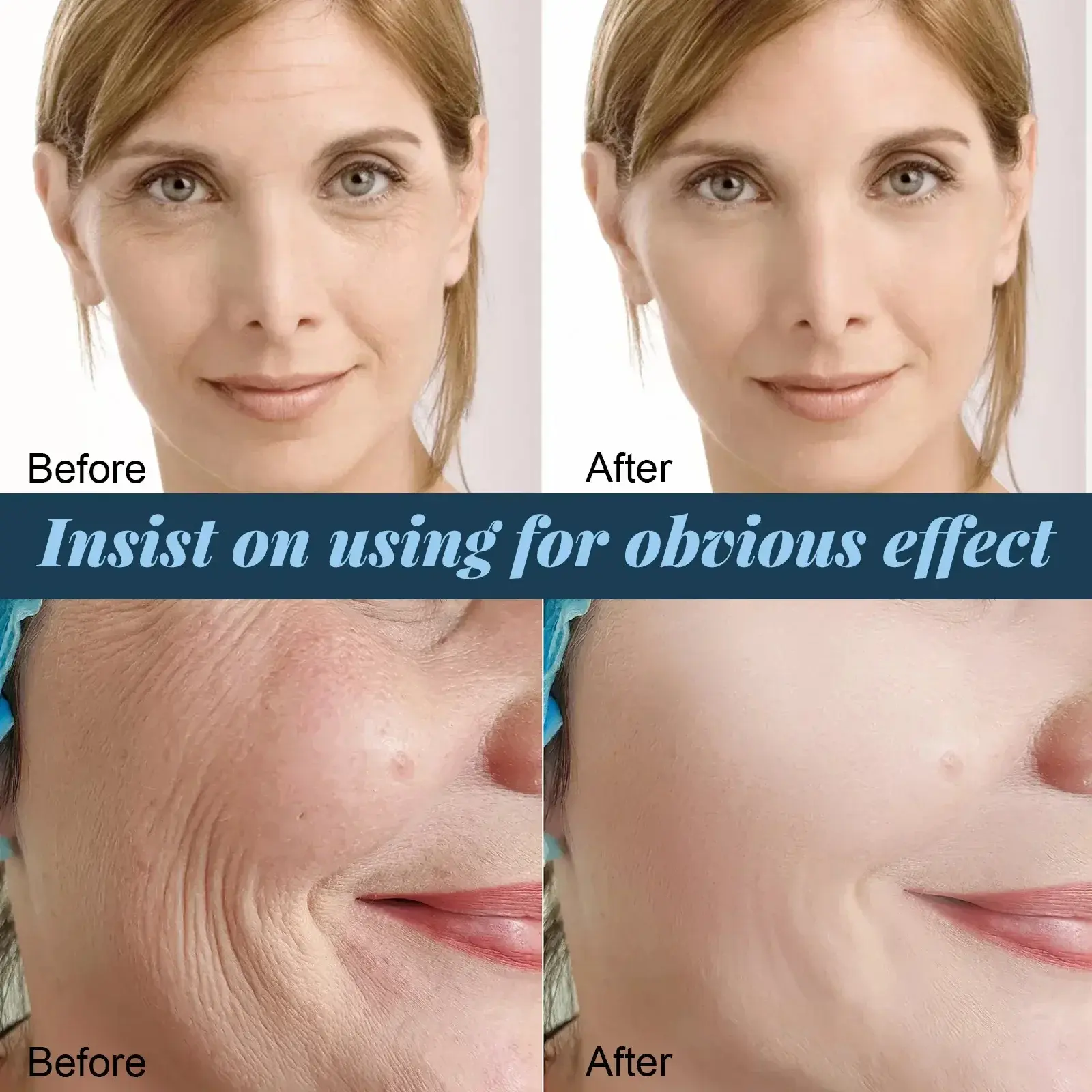 Gold Protein Line Anti-wrinkle Facial Filler Thread Lift Firm Face Serum Absorbable Anti Aging Moisturize Repair Skin Care