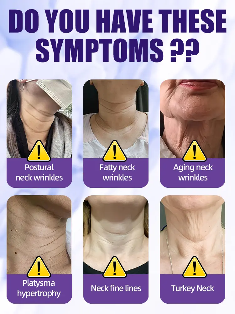 Redinol Neck Cream