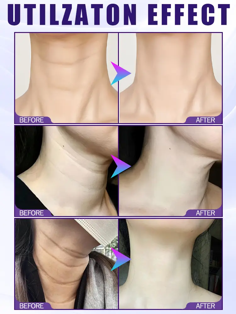 Redinol Neck Cream
