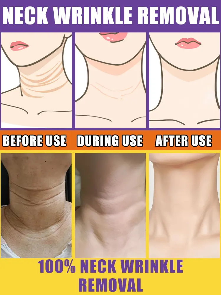 Redinol Neck Cream