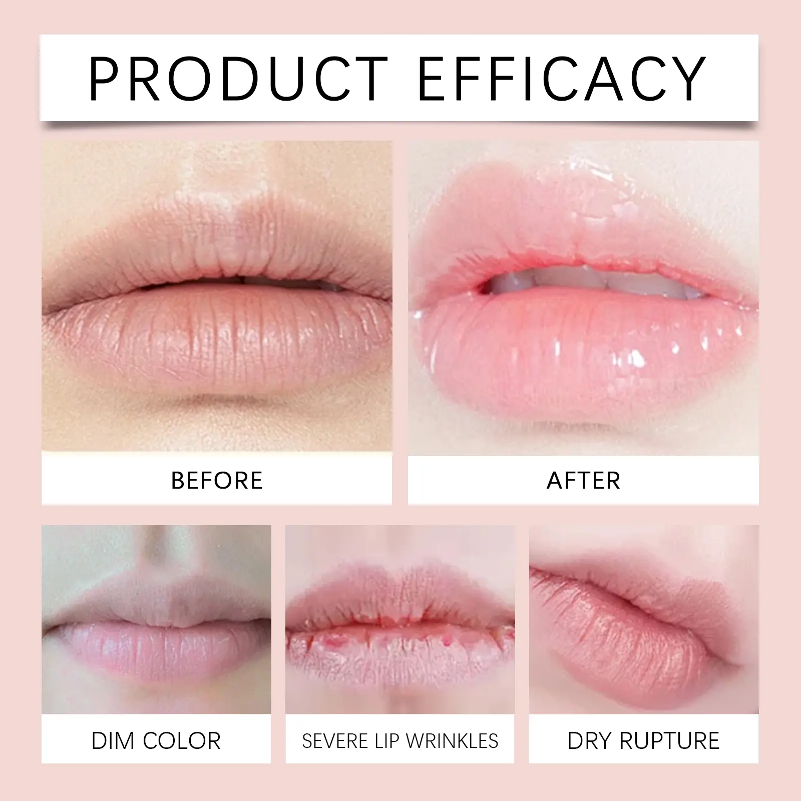 Vitamin E Sakura Lip Moisturizing Gel Supports Dry and flaky lips Moisturizes Lips.Improves Lip Gloss and Lasting Moisturizing