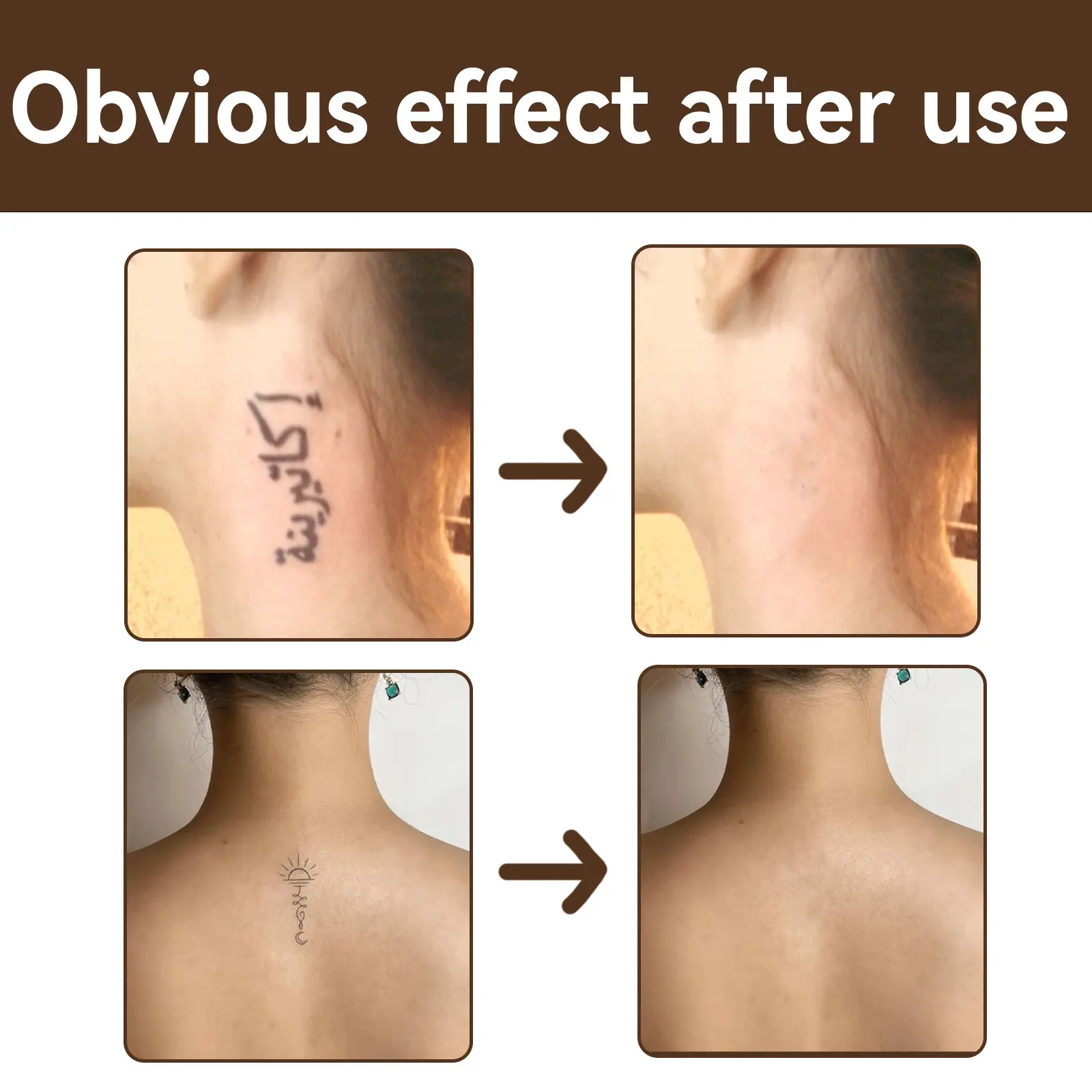EELHOE Tattoo Concealer Cover Scar Birthmarks Spots Hide Blemish Skin Brighten Long Lasting Cover Waterproof Concealer Cream