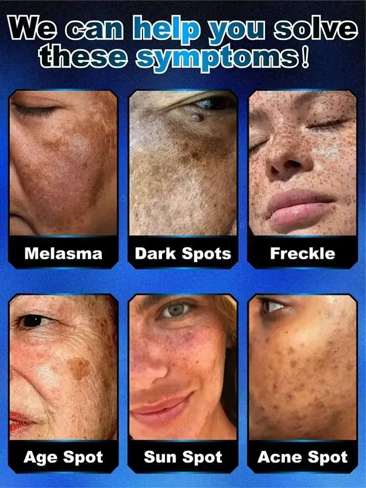 ¹⁰⁰% ˢᵃᶠᵉ ᵃⁿᵈ ᵉᶠᶠᵉᶜᵗⁱᵛᵉ  Regarding facial and body pigmentation, melasma, and pigmentation issues