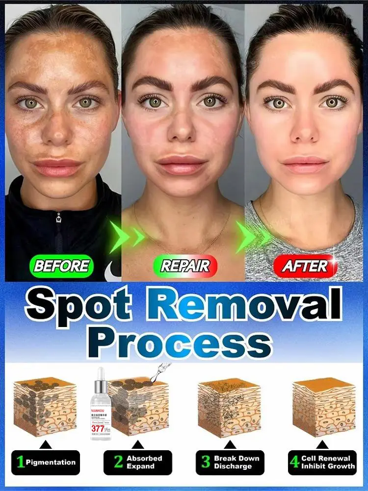 ¹⁰⁰% ˢᵃᶠᵉ ᵃⁿᵈ ᵉᶠᶠᵉᶜᵗⁱᵛᵉ  Regarding facial and body pigmentation, melasma, and pigmentation issues
