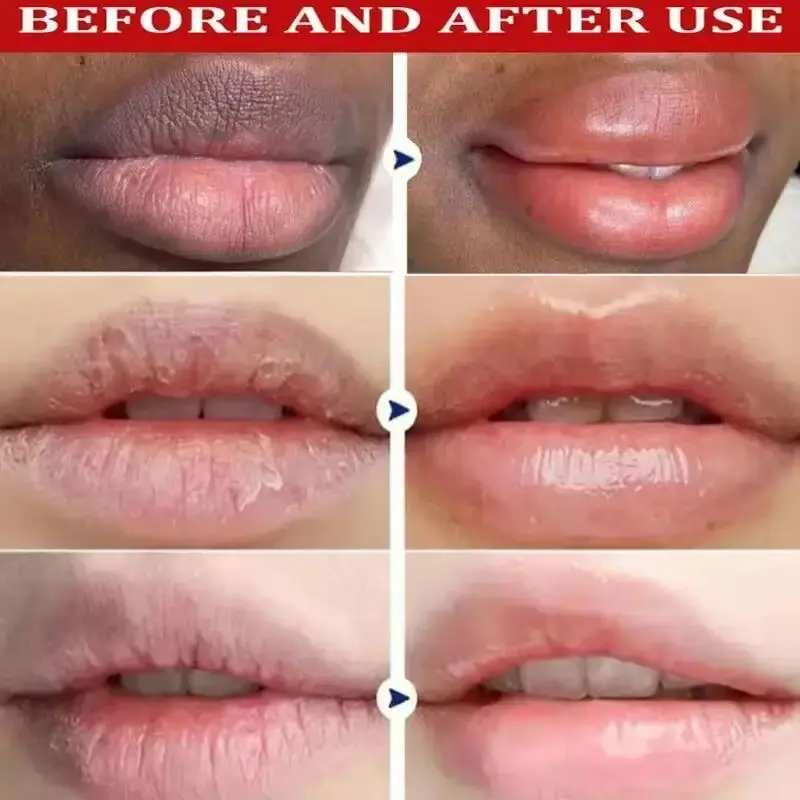 Remove Dark Lip Balm Lightening Melanin Mask Gloss Oil Exfoliating Clean Moisturizer Korean Care Makeup Beauty Health Products