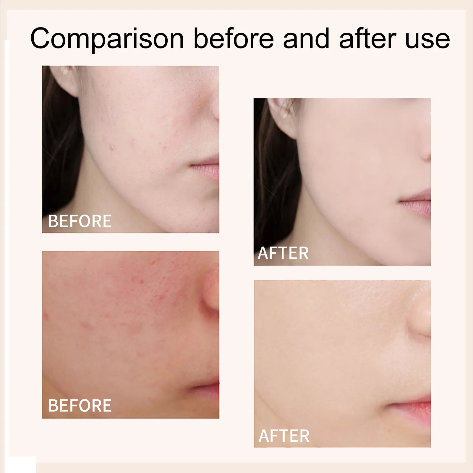 Eelhoe Like White Insulation Cream Moisturizing Anti-oxidant Skin Concealer Covering Pimples Brightening Complexion Primer Cream