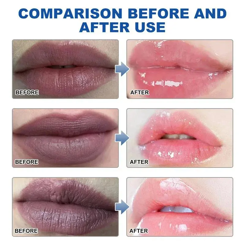 Remove Dark Lip Balm Lighten Melanin Lip Mask Fade Lip Line Brighten Exfoliating Moisturize Dead Skin Repair Lip Care Products