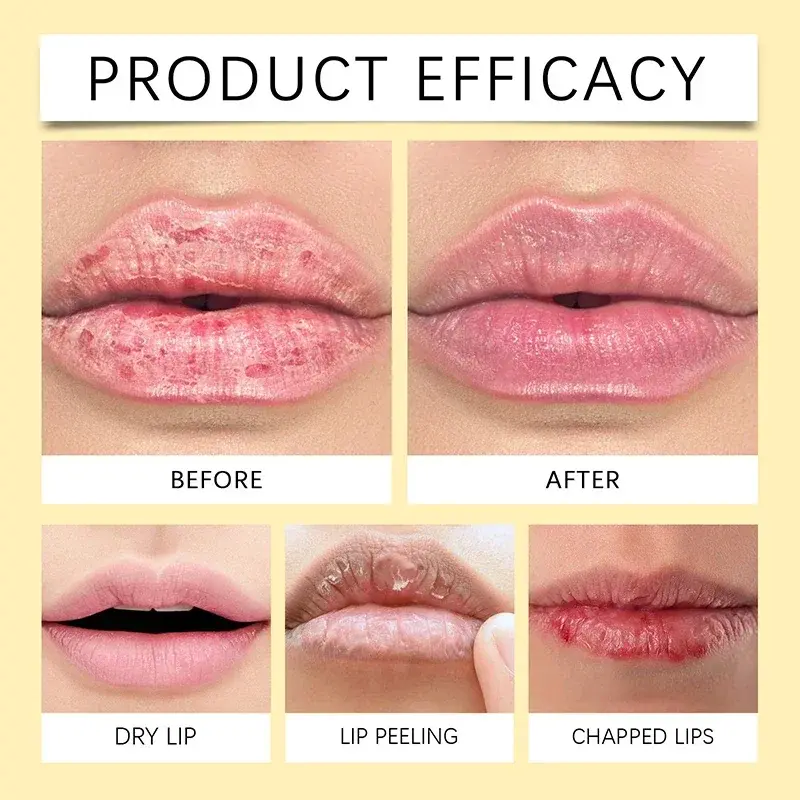 Lemon Ginger Lip Balm Remove Dark Balm Lighten Melanin Mask Gloss Oil Exfoliatings Clean Moisturizing Korean Lip Care Products