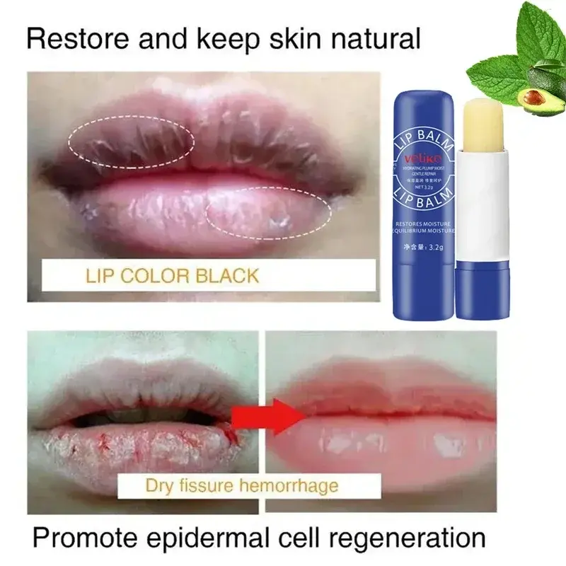Remove Dark Lip Balm Lighten Melanin Lip Mask Exfoliating Fade Lip Line Dead Skin Moisturizing Brighten Repair Lip Care Product
